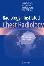 Radiology Illustrated: Chest Radiology af Kyung Soo Lee