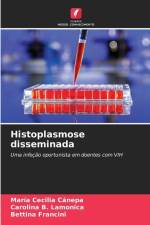 Histoplasmose disseminada af María Cecilia Cánepa