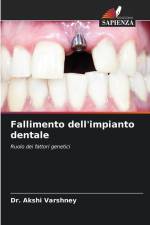 Fallimento dell'impianto dentale af Akshi Varshney