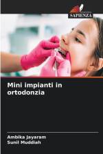Mini impianti in ortodonzia af Ambika Jayaram