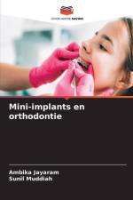 Mini-implants en orthodontie af Ambika Jayaram
