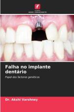 Falha no implante dentário af Akshi Varshney