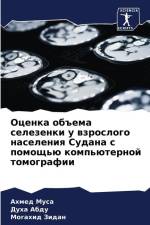 Ocenka ob#ema selezenki u wzroslogo naseleniq Sudana s pomosch'ü komp'üternoj tomografii af Ahmed Musa