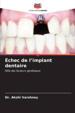 Échec de l¿implant dentaire af Akshi Varshney