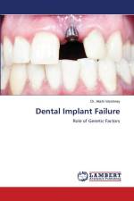 Dental Implant Failure af Akshi Varshney