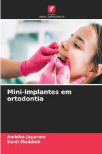Mini-implantes em ortodontia af Ambika Jayaram