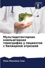 Mul'tidetektornaq komp'üternaq tomografiq u pacientow s biliarnoj atreziej af Rami Mohamed Gazi