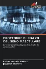 PROCEDURE DI RIALZO DEL SENO MASCELLARE af Khizar Hussain Mazhari
