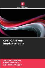 CAD CAM em Implantologia af Supriya Chauhan