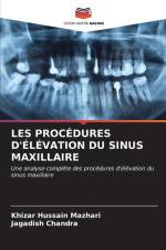 LES PROCÉDURES D'ÉLÉVATION DU SINUS MAXILLAIRE af Khizar Hussain Mazhari