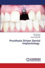 Prosthesis Driven Dental Implantology af Isha Gotmare