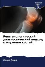 Rentgenologicheskij diagnosticheskij podhod k opuholqm kostej af Linda Audia