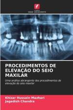 PROCEDIMENTOS DE ELEVAÇÃO DO SEIO MAXILAR af Khizar Hussain Mazhari