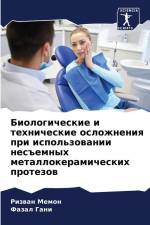Biologicheskie i tehnicheskie oslozhneniq pri ispol'zowanii nes#emnyh metallokeramicheskih protezow af Rizwan Memon