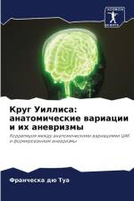 Krug Uillisa: anatomicheskie wariacii i ih anewrizmy af Francheska dü Tua