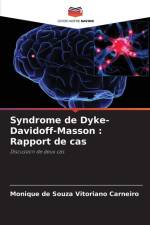 Syndrome de Dyke-Davidoff-Masson : Rapport de cas af Monique de Souza Vitoriano Carneiro