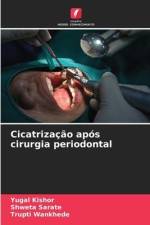 Cicatrização após cirurgia periodontal af Yugal Kishor