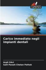 Carico immediato negli impianti dentali af Arpit Sikri
