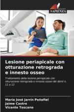 Lesione periapicale con otturazione retrograda e innesto osseo af María José Jarrín Peñafiel