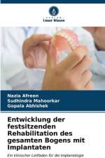 Entwicklung der festsitzenden Rehabilitation des gesamten Bogens mit Implantaten af Nazia Afreen