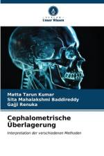 Cephalometrische Überlagerung af Matta Tarun Kumar