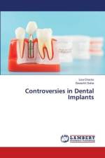 Controversies in Dental Implants af Lisa Chacko