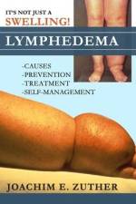 It's Not Just a Swelling! Lymphedema: Causes, Prevention, Treatment, Self-Management af Joachim Zuther