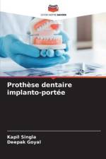 Prothèse dentaire implanto-portée af Kapil Singla