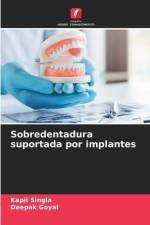 Sobredentadura suportada por implantes af Kapil Singla