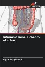 Infiammazione e cancro al colon af Riyan Anggriawan