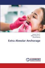 Extra Alveolar Anchorage af Leevan Paul P.