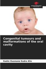 Congenital tumours and malformations of the oral cavity af Kadre Ousmane Kadre Alio