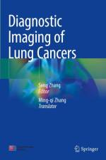 Diagnostic Imaging of Lung Cancers af Song Zhang