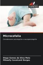 Microcefalia af Diego Gomes Da Silva Melo