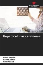 Hepatocellular carcinoma af Amal Khsiba