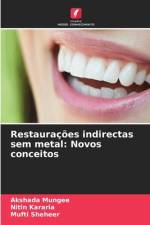Restaurações indirectas sem metal: Novos conceitos af Akshada Mungee