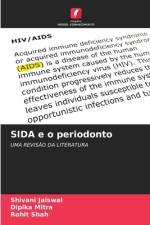 SIDA e o periodonto af Shivani Jaiswal