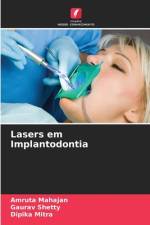 Lasers em Implantodontia af Amruta Mahajan