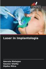 Laser in Implantologia af Amruta Mahajan