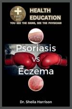 Psoriasis vs. Eczema af Sheila Harrison