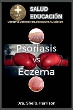Psoriasis vs. Eczema af Dra Sheila Harrison