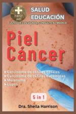Piel Cáncer af Dra Sheila Harrison