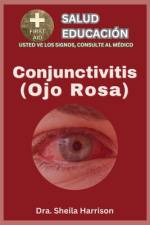 Ojo rosa (conjuntivitis) af Dra Sheila Harrison