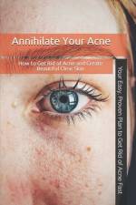 ANNIHILATE YOUR ACNE af Mike Mains
