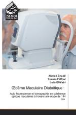OEdeme Maculaire Diabetique af Yousra Falfoul
