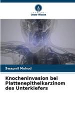 Knocheninvasion bei Plattenepithelkarzinom des Unterkiefers af Swapnil Mohod
