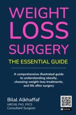 Weight Loss Surgery af Bilal Alkhaffaf