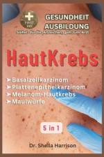 Hautkrebs af Sheila Harrison