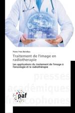 Traitement de l'image en radiotherapie af Pierre-Yves Bondiau