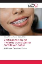 Verticalizacion de molares con sistema cantilever doble af Marquez Reyes Giuliana Marquez Reyes